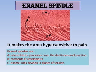 ENAMEL SPINDLE




It makes the area hypersensitive to pain
Enamel spindles are :
A- odontoblastic processes cross the dentinoenamel junction.
B- remnants of ameloblasts.
C- enamel rods develop in planes of tension.
 