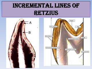 Tooth Retzius Enamel | PPTX