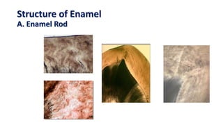 Structure of Enamel
A. Enamel Rod
 