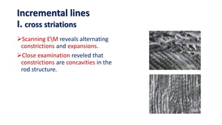 Scanning EM reveals alternating
constrictions and expansions.
Close examination reveled that
constrictions are concavities in the
rod structure.
Incremental lines
I. cross striations
 