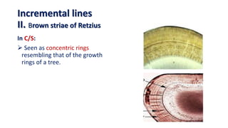 In C/S:
 Seen as concentric rings
resembling that of the growth
rings of a tree.
Incremental lines
II. Brown striae of Retzius
 