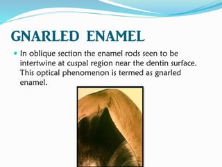 GNARLED ENAMEL
 In oblique section the enamel rods seen to be
intertwine at cuspal region near the dentin surface.
This optical phenomenon is termed as gnarled
enamel.
 