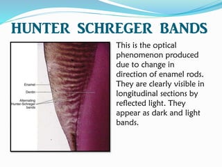 HUNTER SCHREGER BANDS
This is the optical
phenomenon produced
due to change in
direction of enamel rods.
They are clearly visible in
longitudinal sections by
reflected light. They
appear as dark and light
bands.
 
