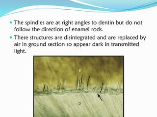  The spindles are at right angles to dentin but do not
follow the direction of enamel rods.
 These structures are disintegrated and are replaced by
air in ground section so appear dark in transmitted
light.
 