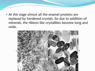  At this stage almost all the enamel proteins are
replaced by hardened crystals. So due to addition of
minerals, the ribbon like crystallites become long and
wide.
 