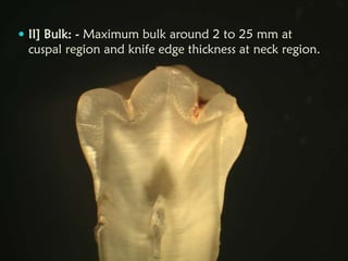  II] Bulk: - Maximum bulk around 2 to 25 mm at
cuspal region and knife edge thickness at neck region.
 