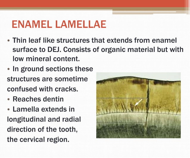 Enamel | PPTX | Dental Health | Diseases and Conditions