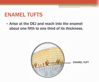 ENAMEL TUFTS
• Arise at the DEJ and reach into the enamel
about one fifth to one third of its thickness.
ENAMEL TUFT
 
