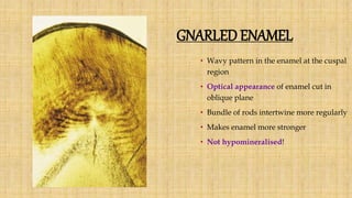 GNARLED ENAMEL
• Wavy pattern in the enamel at the cuspal
region
• Optical appearance of enamel cut in
oblique plane
• Bundle of rods intertwine more regularly
• Makes enamel more stronger
• Not hypomineralised!
 