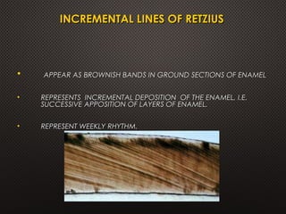 INCREMENTAL LINES OF RETZIUSINCREMENTAL LINES OF RETZIUS
• APPEAR AS BROWNISH BANDS IN GROUND SECTIONS OF ENAMELAPPEAR AS BROWNISH BANDS IN GROUND SECTIONS OF ENAMEL
• REPRESENTS INCREMENTAL DEPOSITION OF THE ENAMEL, I.E.REPRESENTS INCREMENTAL DEPOSITION OF THE ENAMEL, I.E.
SUCCESSIVE APPOSITION OF LAYERS OF ENAMEL.SUCCESSIVE APPOSITION OF LAYERS OF ENAMEL.
• REPRESENT WEEKLY RHYTHM.REPRESENT WEEKLY RHYTHM.
 