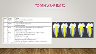 TOOTH WEAR INDEX
 