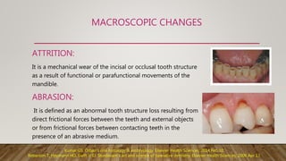 MACROSCOPIC CHANGES
ATTRITION:
It is a mechanical wear of the incisal or occlusal tooth structure
as a result of functional or parafunctional movements of the
mandible.
ABRASION:
It is defined as an abnormal tooth structure loss resulting from
direct frictional forces between the teeth and external objects
or from frictional forces between contacting teeth in the
presence of an abrasive medium.
Kumar GS. Orban's oral histology & embryology. Elsevier Health Sciences; 2014 Feb 10.
Roberson T, Heymann HO, Swift Jr EJ. Sturdevant's art and science of operative dentistry. Elsevier Health Sciences; 2006 Apr 13.
 