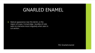 GNARLED ENAMEL
 Optical appearance near the dentin ,in the
region of cusps / incisal edge , bundles of rods
seem to interwine more irregularly when seen in
cut section .
FIG: Gnarled enamel
 
