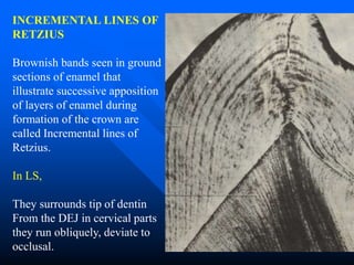 Tooth Retzius TOOTH ENAMEL - HISTOPATHOLOGY FOR STUDENTS | PPT