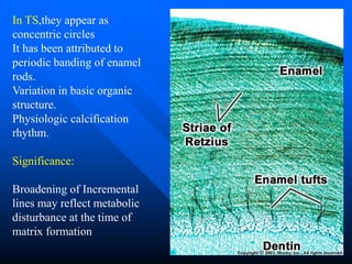 TOOTH ENAMEL - HISTOPATHOLOGY FOR STUDENTS | PPT