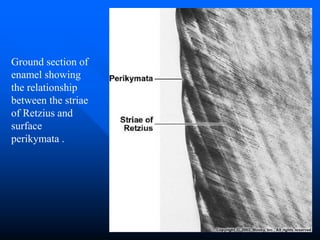 Tooth Retzius TOOTH ENAMEL - HISTOPATHOLOGY FOR STUDENTS | PPT