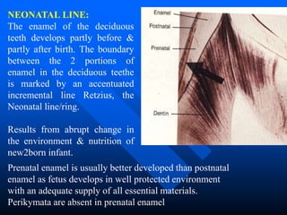 TOOTH ENAMEL - HISTOPATHOLOGY FOR STUDENTS | PPT