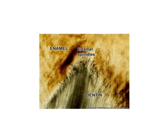 Enamel Creases Final enamel Powerpoint including morphological and histological ...