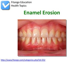 Fitango Education
          Health Topics

                      Enamel Erosion




http://www.fitango.com/categories.php?id=352
 