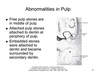 Embedded Pulp Stone Oral Anatomy: Enamel, dentin, and pulp | PPTX