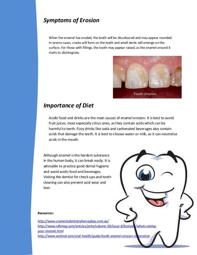 Enamel Erosion and Acid Wear