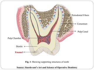 Enamel
Dentin
Pulp Chamber
Pulp Canal
Periodontal Fibers
Cementum
Fig. 1: Showing supporting structures of tooth
Source: Sturdevant’s Art and Science of Operative Dentistry
 