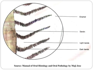 Source: Manual of Oral Histology and Oral Pathology by Maji Jose
 