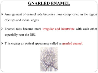 GNARLED ENAMEL
 Arrangement of enamel rods becomes more complicated in the region
of cusps and incisal edges.
 Enamel rods become more irregular and intertwine with each other
especially near the DEJ.
 This creates an optical appearance called as gnarled enamel.
 