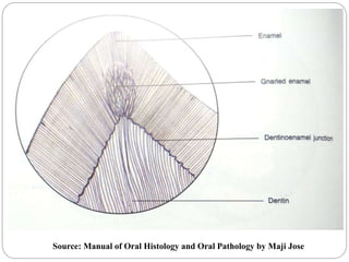 Source: Manual of Oral Histology and Oral Pathology by Maji Jose
 