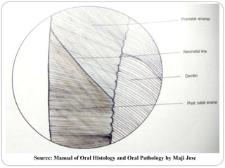 Source: Manual of Oral Histology and Oral Pathology by Maji Jose
 