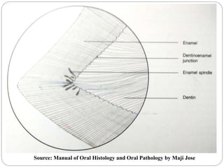 Source: Manual of Oral Histology and Oral Pathology by Maji Jose
 