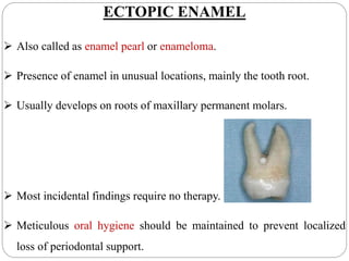 ECTOPIC ENAMEL
 Also called as enamel pearl or enameloma.
 Presence of enamel in unusual locations, mainly the tooth root.
 Usually develops on roots of maxillary permanent molars.
 Most incidental findings require no therapy.
 Meticulous oral hygiene should be maintained to prevent localized
loss of periodontal support.
 