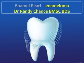 Enamel Pearl – enameloma
Dr Randy Chance BMSC BDS
 