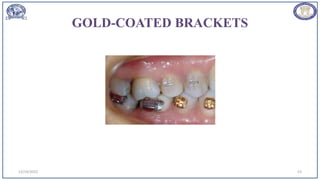 GOLD-COATED BRACKETS
12/19/2023 53
 