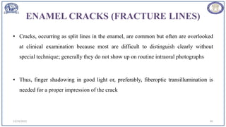 ENAMEL CRACKS (FRACTURE LINES)
• Cracks, occurring as split lines in the enamel, are common but often are overlooked
at clinical examination because most are difficult to distinguish clearly without
special technique; generally they do not show up on routine intraoral photographs
• Thus, finger shadowing in good light or, preferably, fiberoptic transillumination is
needed for a proper impression of the crack
12/19/2023 85
 