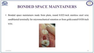 BONDED SPACE MAINTAINERS
• Bonded space maintainers made from plain, round 0.032-inch stainless steel wire
sandblasted terminally for micromechanical retention or from gold-coated 0.030-inch
wire.
12/19/2023 96
 