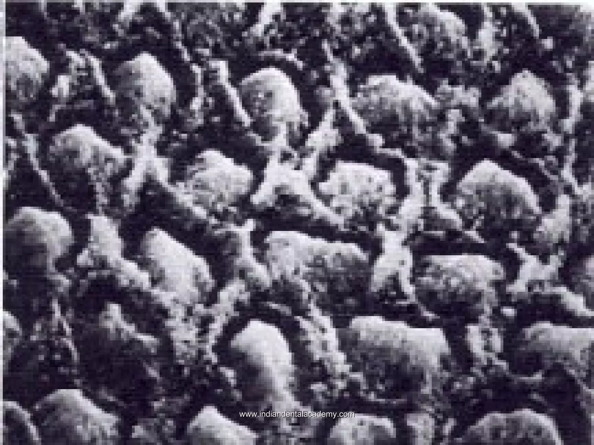  PremmiadAbdul WahabGRABER VANS AC

www.indiandentalacademy.com

 