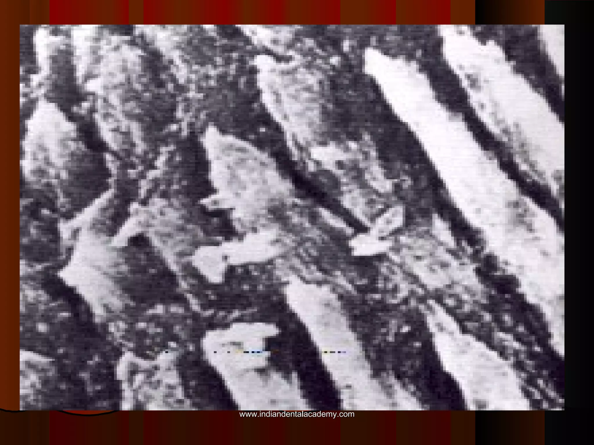  PremmiadAbdul WahabACID3.jpg

www.indiandentalacademy.com

 