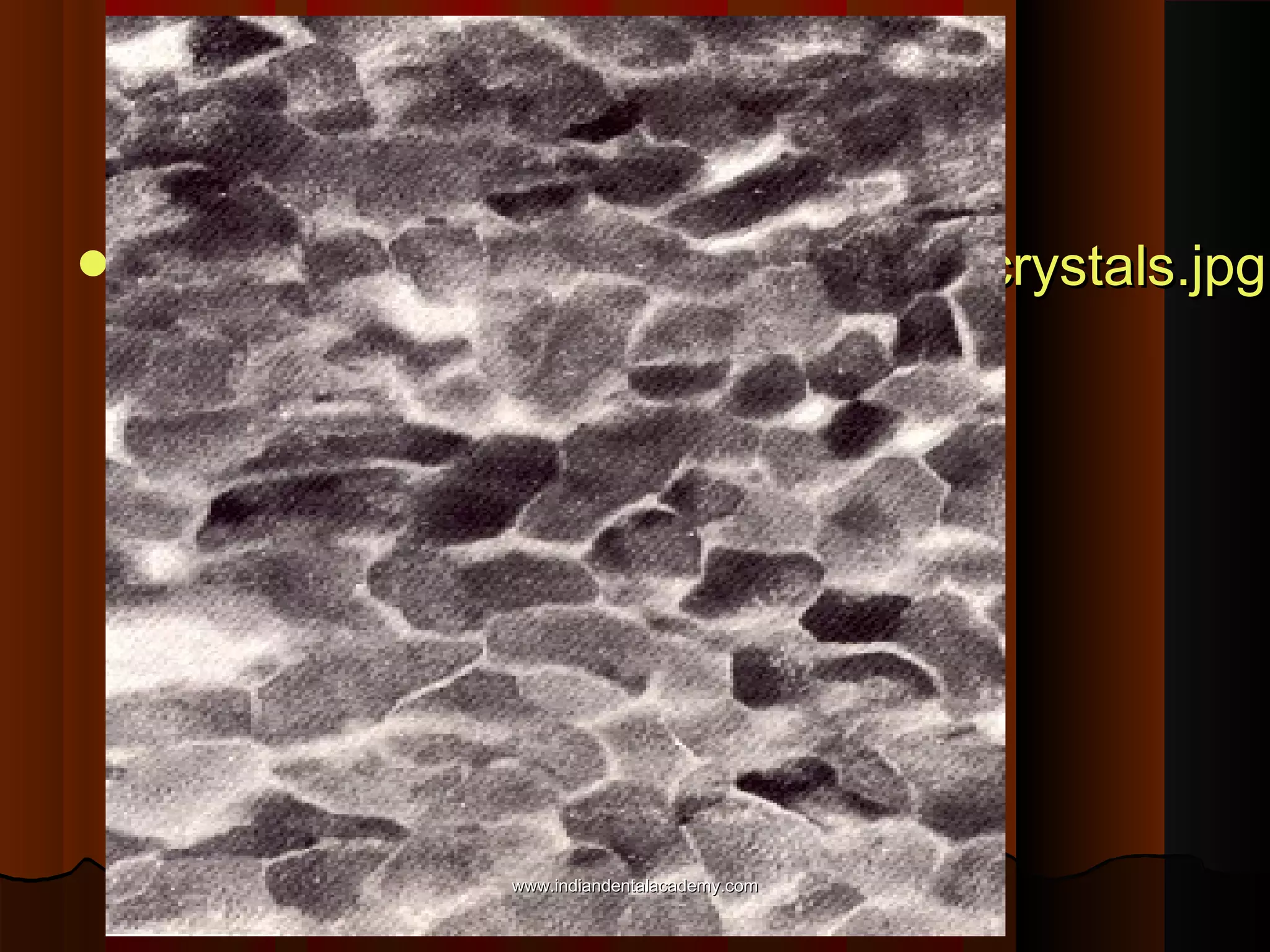  PremmiadAbdul Wahabenamelcrystals.jpg

www.indiandentalacademy.com

 