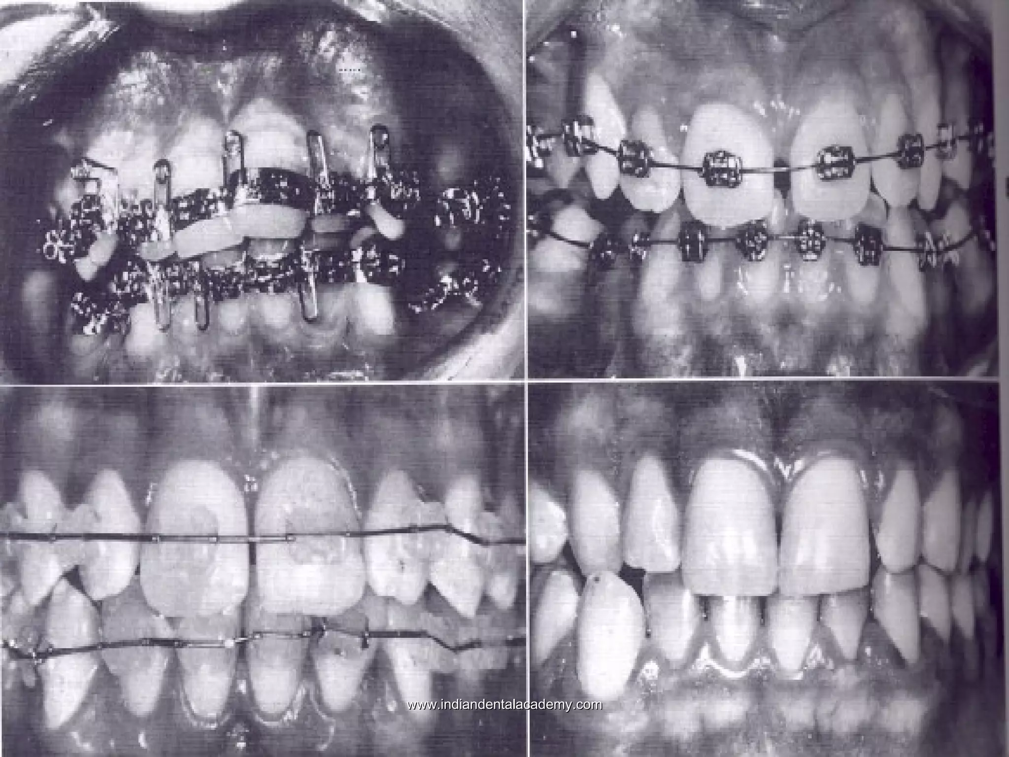  PremmiadAbdul WahabGRABER VANS1.jp

www.indiandentalacademy.com

 