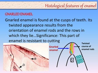 Enamel Creases Enamel presentation. prepared by mohammed yahia | PPTX