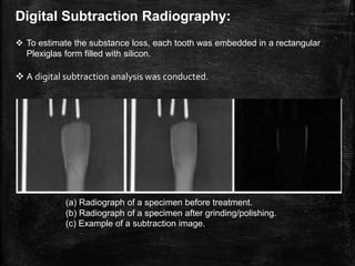 Substraction Radiograph Unit Enamel reduction techniques in orthodontics | PPTX