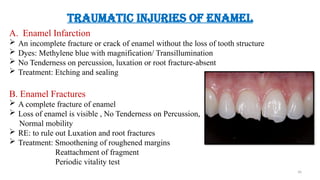 Enamel Infarctions Enamel Seminar - Anu presented.pptx...... | PPTX