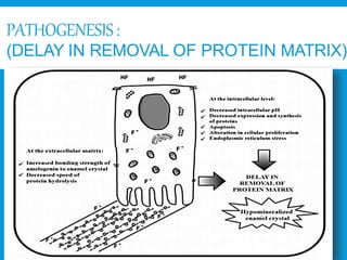 PATHOGENESIS:
(DELAY IN REMOVAL OF PROTEIN MATRIX)
 