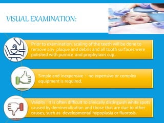 VISUAL EXAMINATION:
Prior to examination, scaling of the teeth will be done to
remove any plaque and debris and all tooth surfaces were
polished with pumice and prophylaxis cup.
Simple and inexpensive : no expensive or complex
equipment is required.
Validity : it is often difficult to clinically distinguish white spots
caused by demineralization and those that are due to other
causes, such as developmental hypoplasia or fluorosis.
 