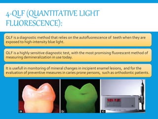 4-QLF (QUANTITATIVE LIGHT
FLUORESCENCE):
QLF is a diagnostic method that relies on the autoﬂuorescence of teeth when they are
exposed to high-intensity blue light.
QLF is a highly sensitive diagnostic test, with the most promising fluorescent method of
measuring demineralization in use today.
It is usefull in monitoring of mineral changes in incipient enamel lesions, and for the
evaluation of preventive measures in caries prone persons, such as orthodontic patients.
 