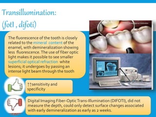 ↑↑sensitivity and
specificity
Transillumination:
(fotI , difoti)
Digital Imaging Fiber-OpticTrans-Illumination (DIFOTI), did not
measure the depth, could only detect surface changes associated
with early demineralization as early as 2 weeks.
The ﬂuorescence of the tooth is closely
related to the mineral content of the
enamel, with demineralization showing
less ﬂuorescence.The use of fiber optic
light makes it possible to see smaller
superficial optical refraction white
lesions; it undergoes by passing an
intense light beam through the tooth
 