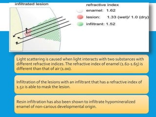 Light scattering is caused when light interacts with two substances with
different refractive indices.The refractive index of enamel (1.62-1.65) is
different than that of air (1.00).
Infiltration of the lesions with an infiltrant that has a refractive index of
1.52 is able to mask the lesion.
Resin infiltration has also been shown to infiltrate hypomineralized
enamel of non-carious developmental origin.
 