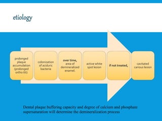 prolonged
plaque
accumulation
(prolonged
ortho ttt)
colonization
of aciduric
bacteria
over time,
area of
demineralized
enamel.
active white
spot lesion
if not treated,
cavitated
carious lesion
Dental plaque buffering capacity and degree of calcium and phosphate
supersaturation will determine the demineralization process
 