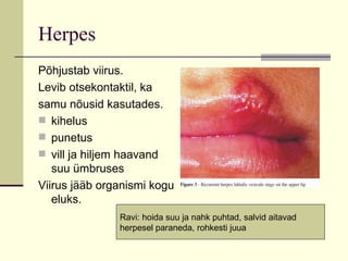 Herpes Põhjustab viirus. Levib otsekontaktil, ka samu nõusid kasutades. kihelus punetus vill ja hiljem haavand suu ümbruses Viirus jääb organismi kogu eluks. Ravi: hoida suu ja nahk puhtad, salvid aitavad  herpesel paraneda, rohkesti juua 